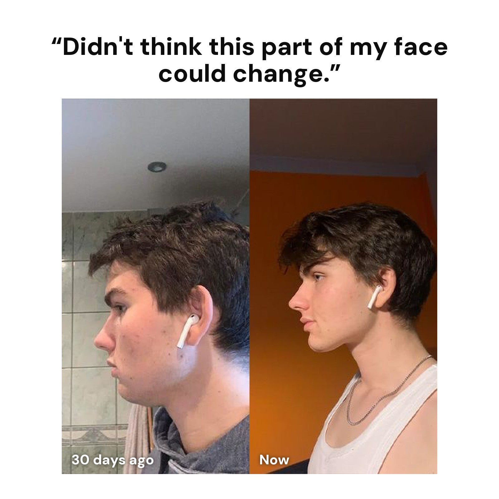 Before and after side profile 30 days apart after HYOIDR training